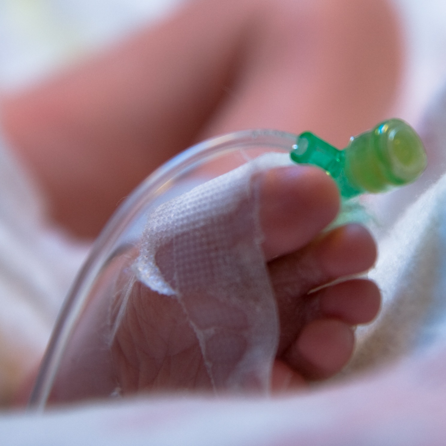 MOBILE EYE TRACKING FOR MEDICAL TRAINING: LIVE WEBINAR WITH  MD PhD MICHAEL WAGNER, MEDICAL UNIVERSITY OF VIENNA